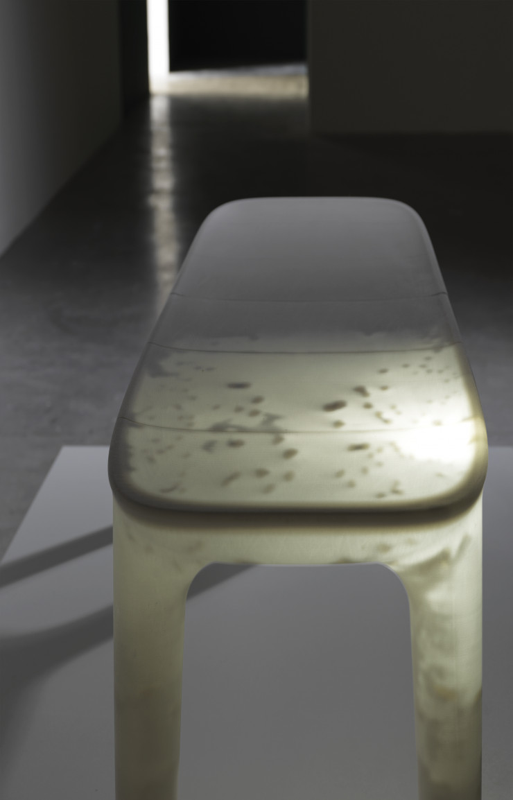 La micro caméra se promène à l’intérieur de l’assise, une haute technologie chirurgicale permise par la collaboration avec le professeur Marescaux de l’IRCAD.